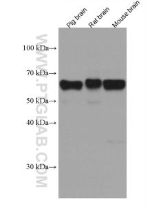 ACVR1 Monoclonal antibody proteintech 67417-1-Ig