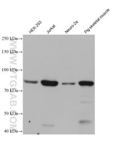 PI3 Kinase p85 Alpha Monoclonal antibody proteintech 60225-1-Ig