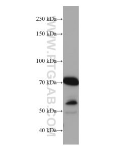MAVS; VISA Monoclonal antibody proteintech 66911-1-Ig