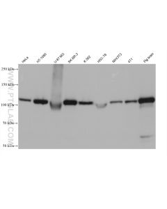 Hexokinase 1 Monoclonal antibody proteintech 68419-1-Ig