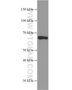 Fibulin 5 Monoclonal antibody proteintech 60081-1-Ig