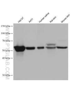 Cytokeratin 5/6 Monoclonal antibody proteintech 68295-1-Ig