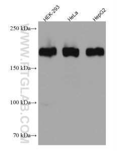 ZEB1 Monoclonal antibody proteintech 66279-1-Ig