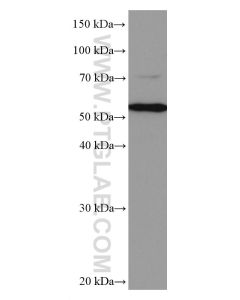 CYP27A1 Monoclonal antibody proteintech 67045-1-Ig