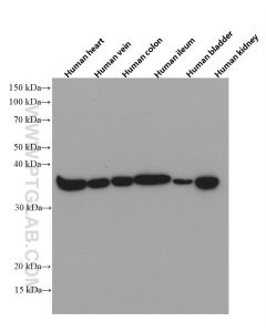 Calponin 1 Monoclonal antibody proteintech 66540-1-Ig