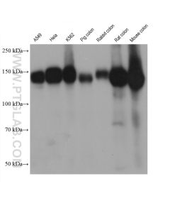 Integrin alpha-5/CD49e Monoclonal antibody proteintech 68561-1-Ig