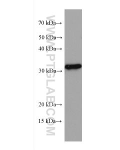 KLRB1/CD161 Monoclonal antibody proteintech 67537-1-Ig