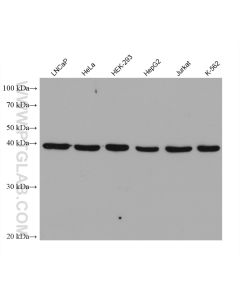 TDP-43 (human specific) Monoclonal antibody proteintech 60019-2-Ig