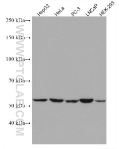GPI Monoclonal antibody proteintech 67178-1-Ig
