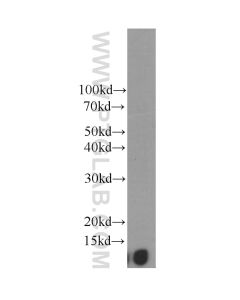 Beta-2-Microglobulin Monoclonal antibody proteintech 66207-1-Ig