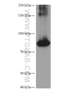 Phospho-STAT3 (Ser727) Monoclonal antibody proteintech 60479-1-Ig