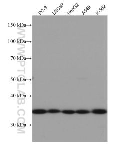 REDD1 Monoclonal antibody proteintech 67059-1-Ig
