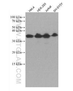 ATF5 Monoclonal antibody proteintech 67066-1-Ig