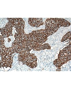 HER2/ErbB2 Monoclonal antibody proteintech 60311-1-Ig