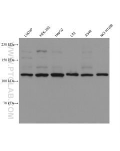 FGFR3 Monoclonal antibody proteintech 66954-1-Ig