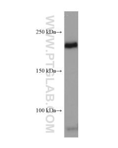 VEGFR2/KDR Monoclonal antibody proteintech 67407-1-Ig