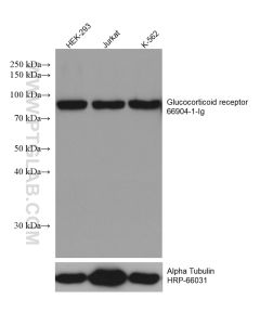 Glucocorticoid receptor Monoclonal antibody proteintech 66904-1-Ig