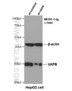 VAPB Monoclonal antibody proteintech 66191-1-Ig
