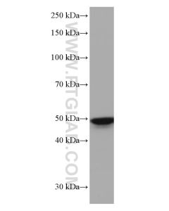 TFAP2A/AP-2 Monoclonal antibody proteintech 67076-1-Ig