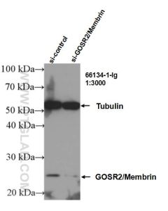 GOSR2/Membrin Monoclonal antibody proteintech 66134-1-Ig