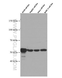 Cytokeratin 7 Monoclonal antibody proteintech 66483-1-Ig