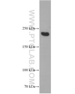 MYH2-specific Monoclonal antibody proteintech 66212-1-Ig