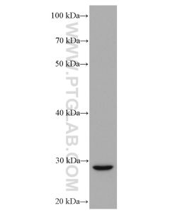 TRAIL/CD253 Monoclonal antibody proteintech 66756-1-Ig