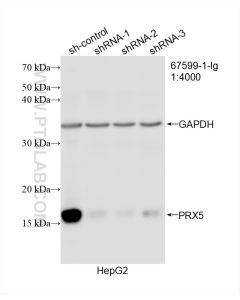 PRX5 Monoclonal antibody proteintech 67599-1-Ig