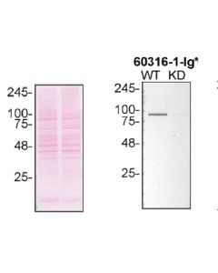 VCP Monoclonal antibody proteintech 60316-1-Ig