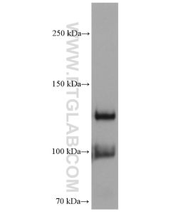 VE-cadherin/CD144 Monoclonal antibody proteintech 66804-1-Ig