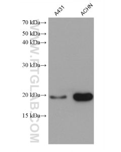 HOXA7 Monoclonal antibody proteintech 67112-1-Ig