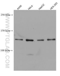USP25 Monoclonal antibody proteintech 67769-1-Ig