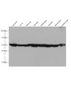 TUBB3-specific/TUJ1 Monoclonal antibody proteintech 66375-1-Ig