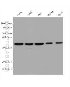 MCL1 Monoclonal antibody proteintech 66026-1-Ig