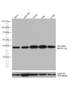 IkB Alpha Monoclonal antibody proteintech 66418-1-Ig