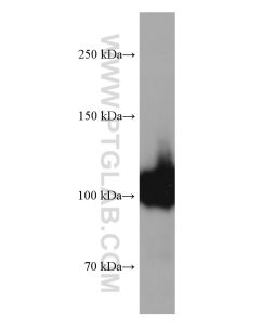 CD34 Monoclonal antibody proteintech 60180-2-Ig