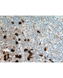 S100A8 Monoclonal antibody proteintech 66853-1-Ig