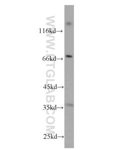 CD7 Monoclonal antibody proteintech 60209-1-Ig