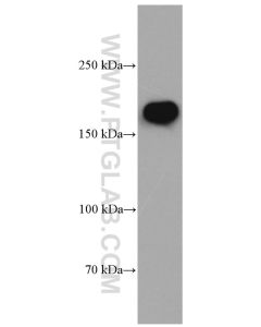 NMDAR2B/GRIN2B Monoclonal antibody proteintech 66565-1-Ig