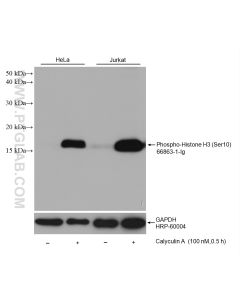 Phospho-Histone H3 (Ser10) Monoclonal antibody proteintech 66863-1-Ig