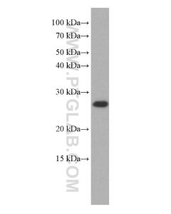 COMMD5 Monoclonal antibody proteintech 67043-1-Ig