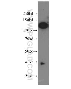 CD146/MCAM Monoclonal antibody proteintech 66153-1-Ig