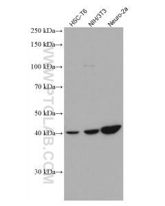 SSTR5 Monoclonal antibody proteintech 66772-1-Ig