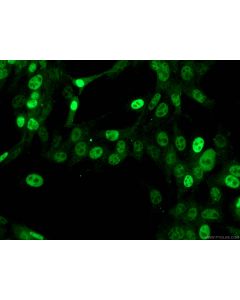 p21 Monoclonal antibody proteintech 67362-1-Ig