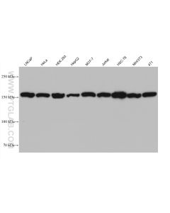 Ataxin 2 Monoclonal antibody proteintech 68316-1-Ig