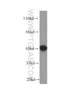 Cytokeratin 20 Monoclonal antibody proteintech 60183-1-Ig