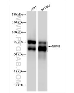 NUMB Recombinant monoclonal antibody proteintech 85939-4-RR