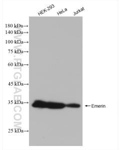 Emerin Recombinant monoclonal antibody proteintech 82888-3-RR