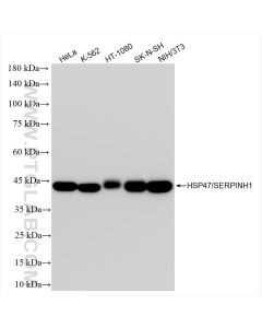 HSP47/SERPINH1 Recombinant monoclonal antibody proteintech 83689-3-RR