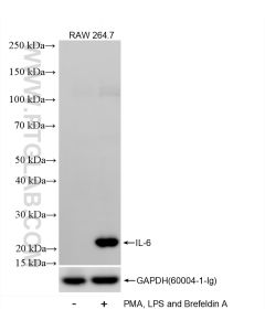 IL-6 Recombinant monoclonal antibody proteintech 83795-7-RR